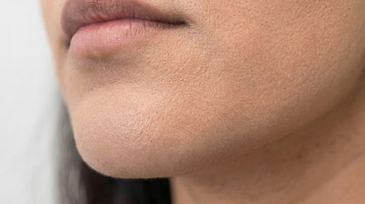 Chin Threading